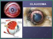 penyakit glaukoma